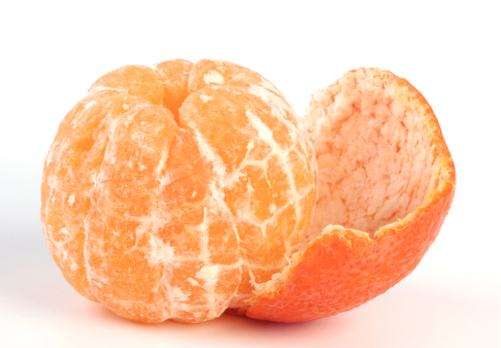 Analogía de la naranja pelada: el HoLEP retira el adenoma completo y deja intacta la cápsula de la próstata