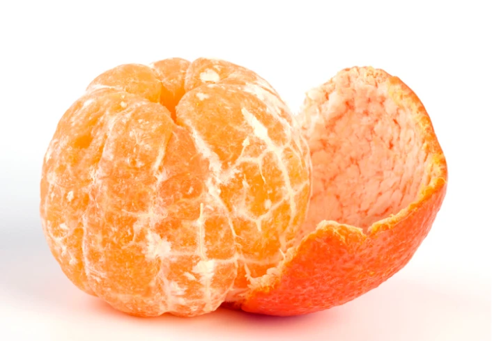 Analogía de la naranja pelada: el HoLEP retira el adenoma completo y deja intacta la cápsula de la próstata
